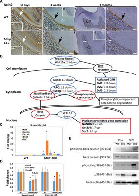 The Critical Role of MMP13 in Regulating Tooth Development and Reactionary Dentinogenesis Repair Through the Wnt Signaling Pathway